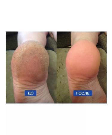 NANO-HEELS Hael for heels Removing keratinity - Buy Online on GoSupps.com