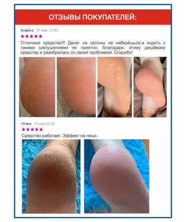 NANO-HEELS Hael for heels Removing keratinity - Buy Online on GoSupps.com