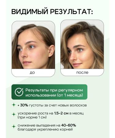 OG Beaute Actic spray for hair growth with magnesium and nettles - Buy Online on GoSupps.com