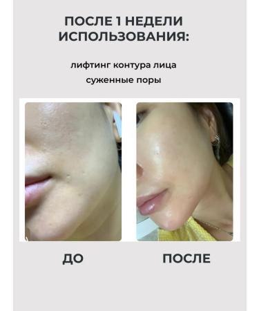 Dr Reborn Anti -aging serum for the face with microeles and exosomes - Buy Online on GoSupps.com