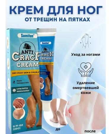 Vlar BEAUTY Light cream from dryness and cracks