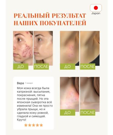 Tokishi LV Acne acne cream serum - Buy Online on GoSupps.com