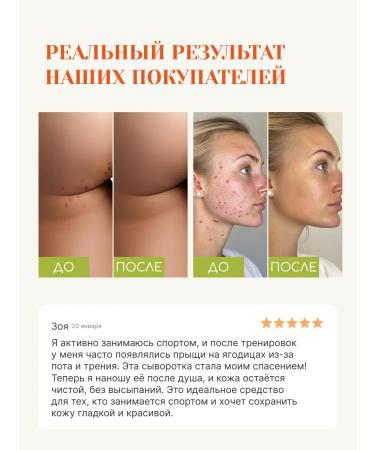 Tokishi LV Acne acne cream serum - Buy Online on GoSupps.com