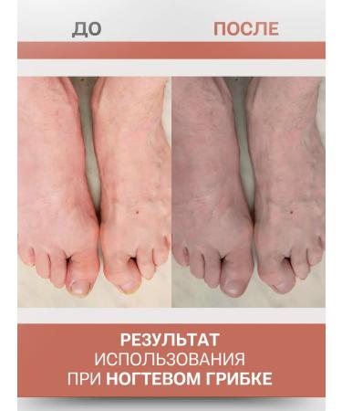 108 herbs Antifungal tool for nails on the legs and from thrush - Buy Online on GoSupps.com