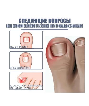 West & Month Gel for Oil from Grown Nails on the Legs - Buy Online on GoSupps.com