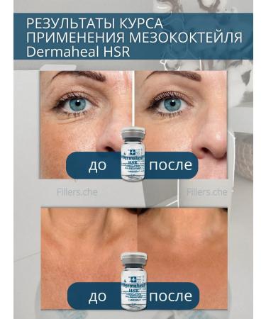 Dermaheal HSR dermakhil serum for wrinkles 5 pcs - Buy Online on GoSupps.com