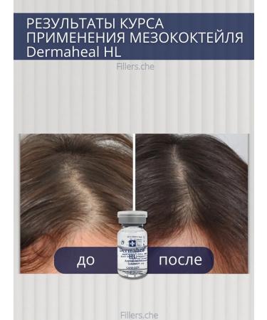 Dermaheal Her hair dermakhil serum 10 pcs - Buy Online on GoSupps.com