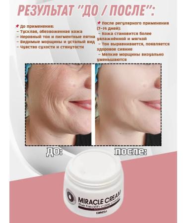 Miracle Cream from pigmentation - Buy Online on GoSupps.com