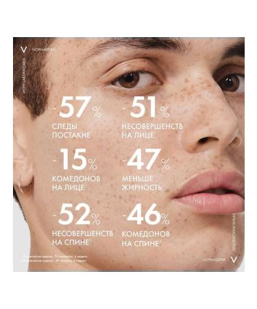 VICHY Facial and body serum cleansing with the effect of peeling - Buy Online on GoSupps.com