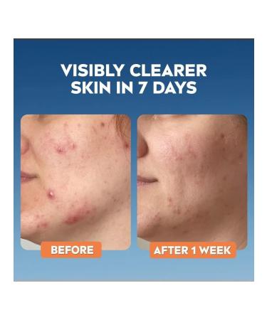 Nivea Derma Skin Clear Facial Facial Scrub 150 ml - Buy Online on GoSupps.com