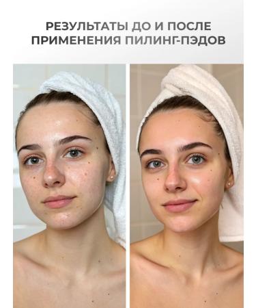 Celimax Toning pyling padds for the face exfoliating 60 pcs - Buy Online on GoSupps.com