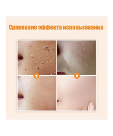 Facial scrub exfoliating 100 ml - Buy Online on GoSupps.com
