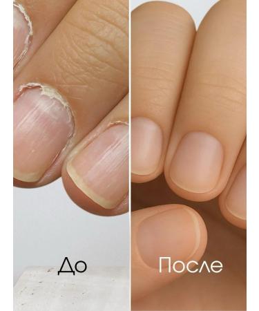 Bandi Multi-serum Nail Cure Pink Diaa Serum Mool - Buy Online on GoSupps.com