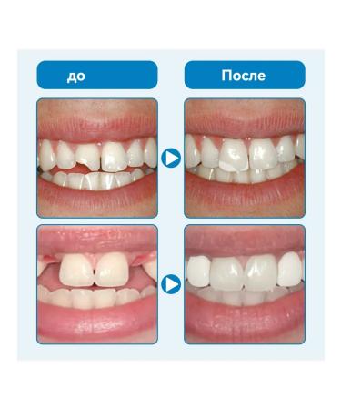 Set of rejectors 3pcs - Buy Online on GoSupps.com