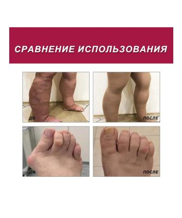 SOUTH MOON Pains the joints Cream corrects bone deformation - Buy Online on GoSupps.com