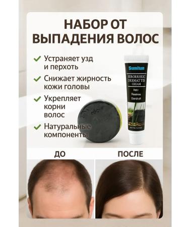 Safiya2 Anti-hair loss kit