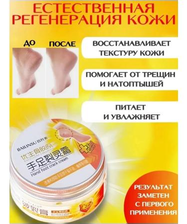 Cream from cracks for very dry skin - Buy Online on GoSupps.com