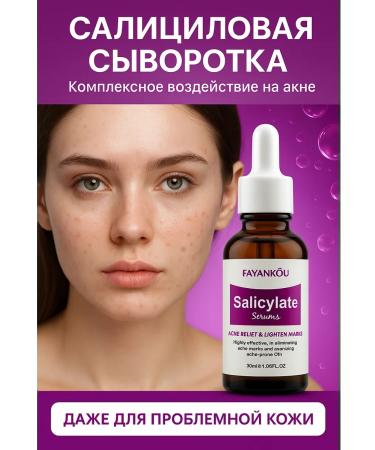 No Complaints Acne and acne serum