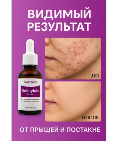 No Complaints Acne and acne serum - Buy Online on GoSupps.com