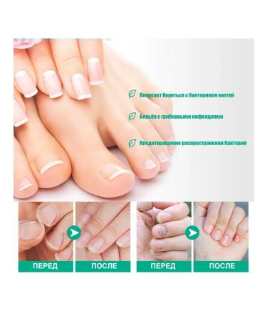 OUHOE Failure Cares for nails nail shine - Buy Online on GoSupps.com