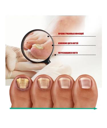 OUHOE Failure Cares for nails nail shine - Buy Online on GoSupps.com