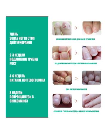 OUHOE Failure Cares for nails nail shine - Buy Online on GoSupps.com