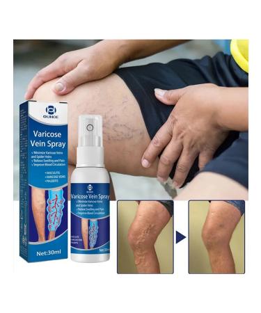 Ouhoe Spray from varicose veins will calm your legs - Buy Online on GoSupps.com