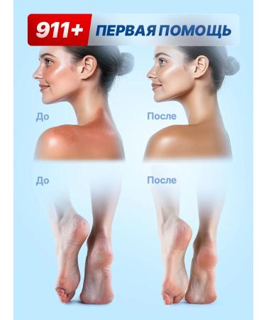 911 + Your emergency service Healing cream Panthenol 5% after tanning - Buy Online on GoSupps.com