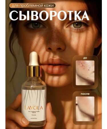 LAVOLA Facial serum from acne and acne 30 ml