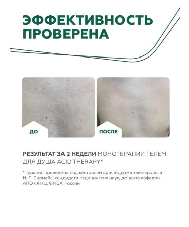 Geltek Shower gel with Acid Therapy acids 390 ml - Buy Online on GoSupps.com