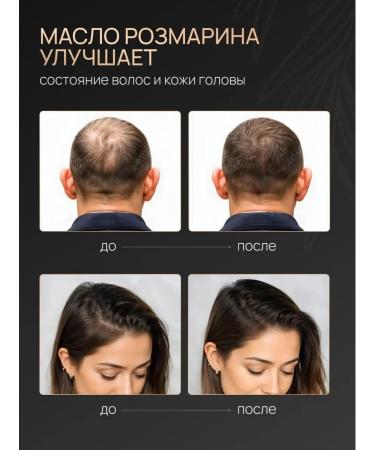 Handy Rosemary oil set for hair growth 2x30ml - Buy Online on GoSupps.com