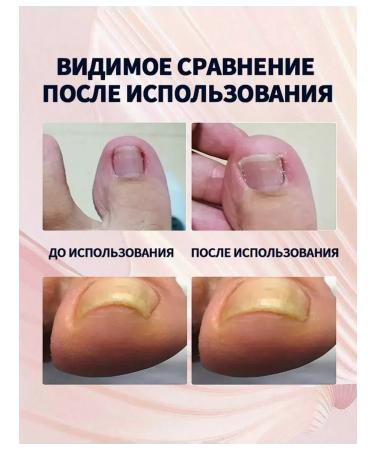 JaySuing nail care - Buy Online on GoSupps.com