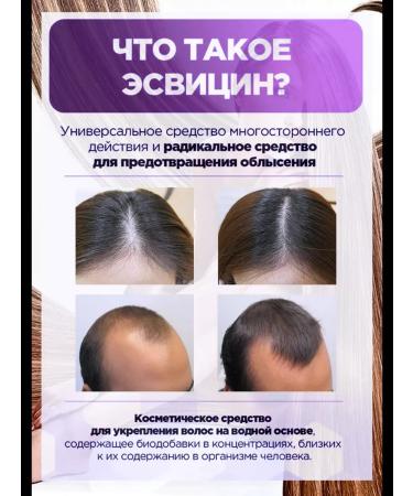 Esvicin Lotion Tonik for hair growth and from falling out the original - Buy Online on GoSupps.com