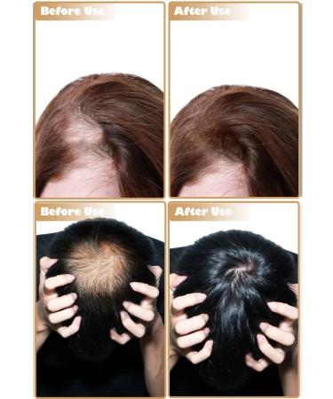 CNMOFAXIN Serum for growth and against hair loss - Buy Online on GoSupps.com