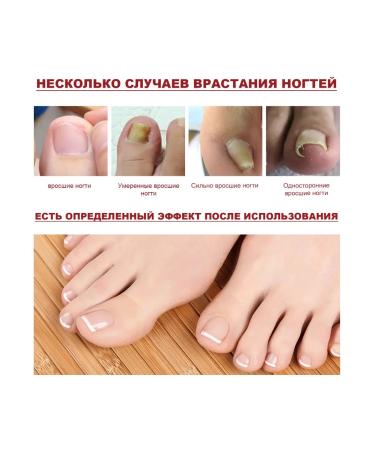 Jaysuing nail oil "Restoration - Buy Online on GoSupps.com