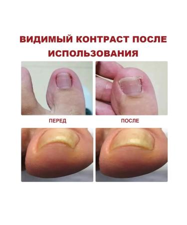 Jaysuing nail oil "Restoration - Buy Online on GoSupps.com
