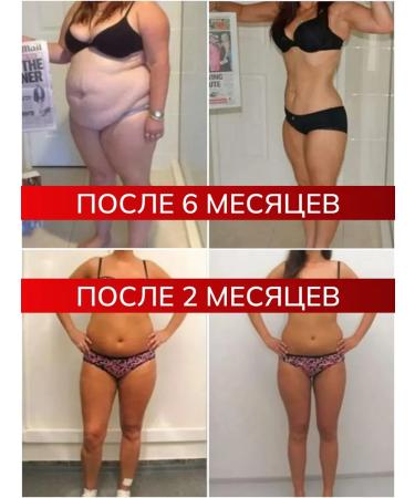 Weight loss tablets + Sunmy anti -ore gel - Buy Online on GoSupps.com