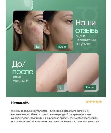 ECOHOLY LC Face cream Anti-Acne - Buy Online on GoSupps.com