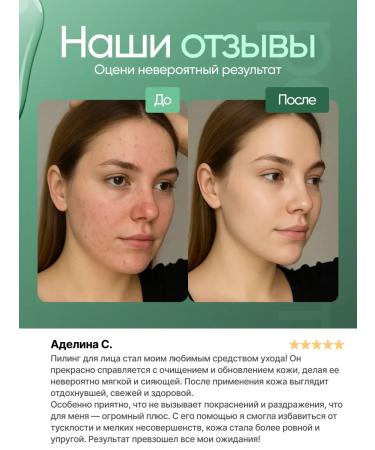 ECOHOLY LC Bloody Piling for Facial - Buy Online on GoSupps.com