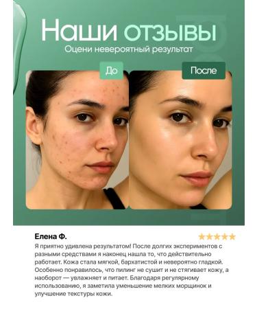 ECOHOLY LC Bloody Piling for Facial - Buy Online on GoSupps.com