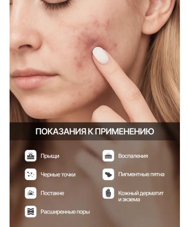 Waski Anti-acne and post-acne cream - Buy Online on GoSupps.com