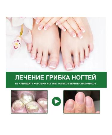 eelhoe Repair of gray nails protecting the nutrient fluid 30 ml - Buy Online on GoSupps.com