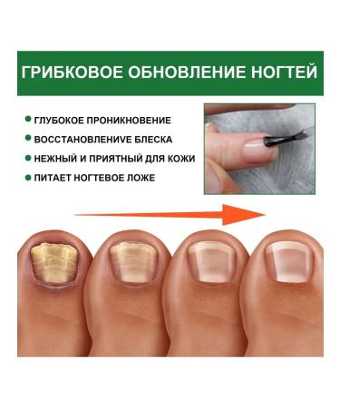 eelhoe Repair of gray nails protecting the nutrient fluid 30 ml - Buy Online on GoSupps.com