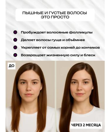 FRAUPROF Lotion for recovery density and hair growth - Buy Online on GoSupps.com