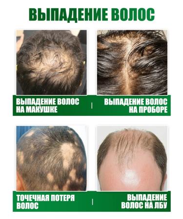 Disaar Hair loss to grow hair - Buy Online on GoSupps.com