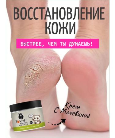 Tokishi Moisturizer with urea