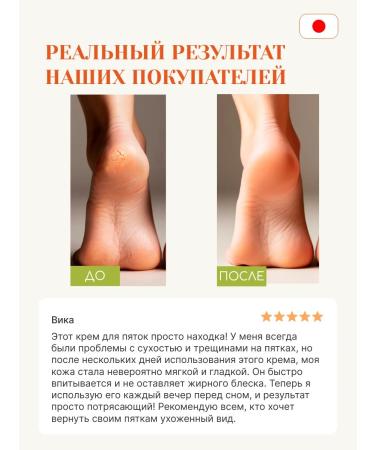 Tokishi Moisturizer with urea - Buy Online on GoSupps.com