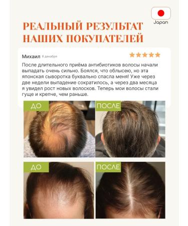 Tokishi P Hair growth with rosemary oil - Buy Online on GoSupps.com