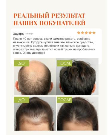 Tokishi LV Hair growth with rosemary - Buy Online on GoSupps.com