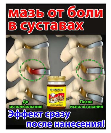 Ointment from the hernia of the spine 55 ml